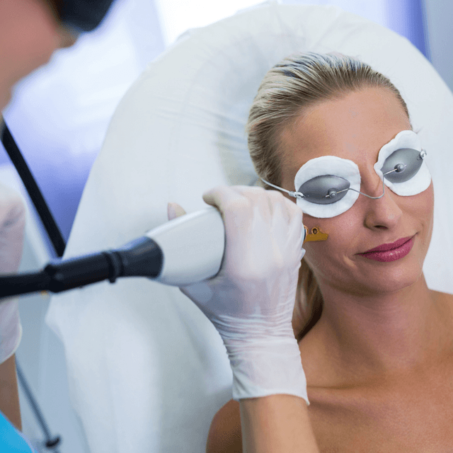Laser treatment consultation