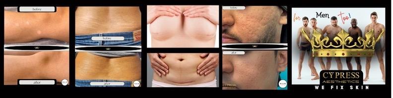 Cypress Aesthetics Inc.