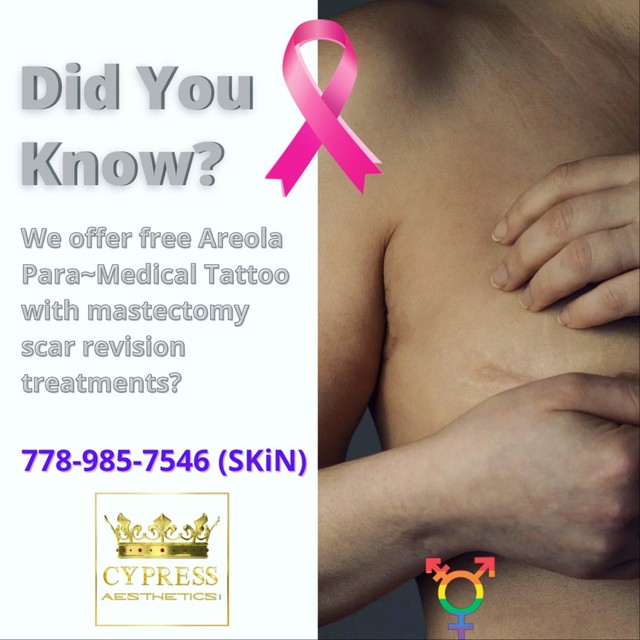 3D Para-Medical Areola Tattoo