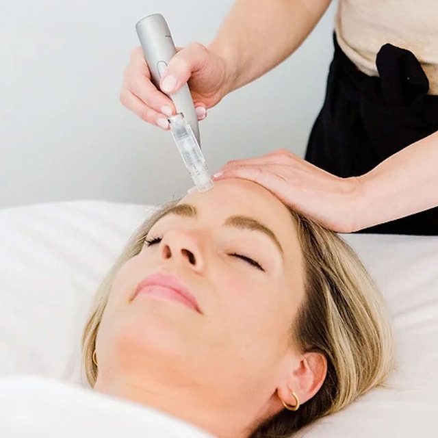 20% off with Molly KdM Triple Rejuvenation with VAMP