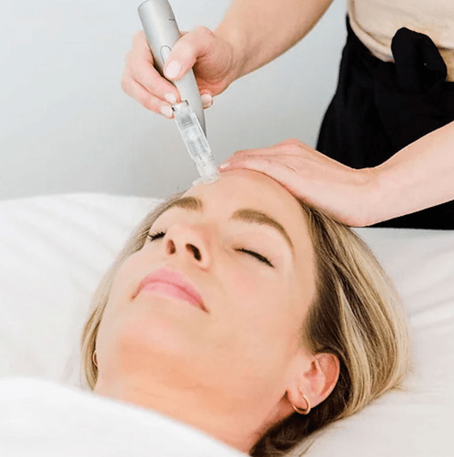 20% off with April Microneedling w/ Exosome booster