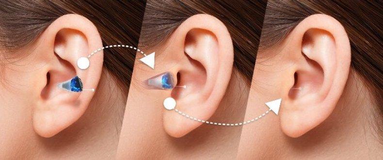 ACE Audiology - Hearing Aids & Hearing Tests
