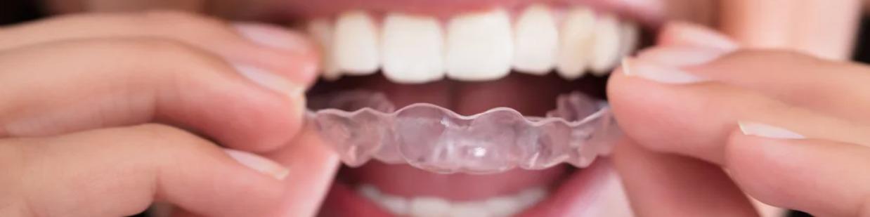 Acorn Dental & Implant Center