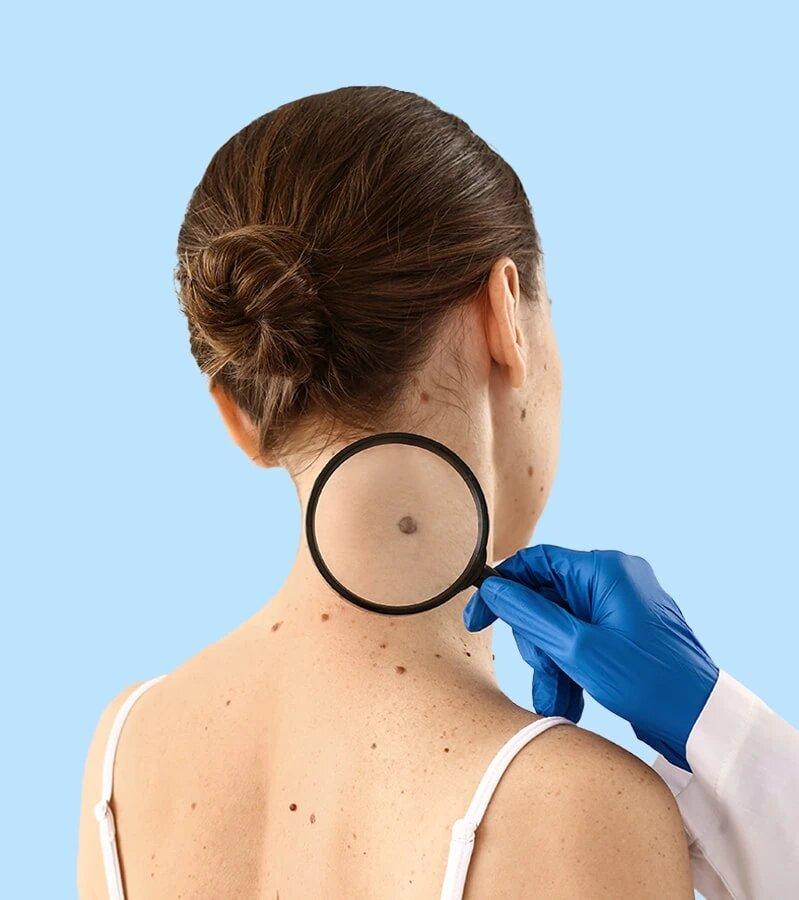 Lotus Skin Check Clinic