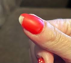 Gel nail repair