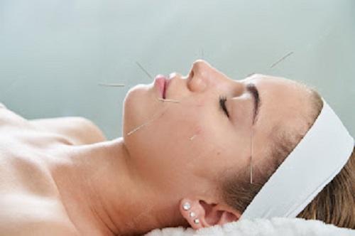 Zen Acupuncture Clinic