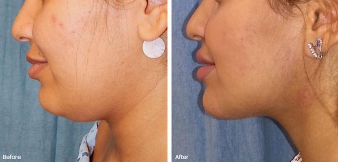 Belmont Plastic Surgery