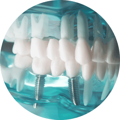 Smile Now Dental Implant Center