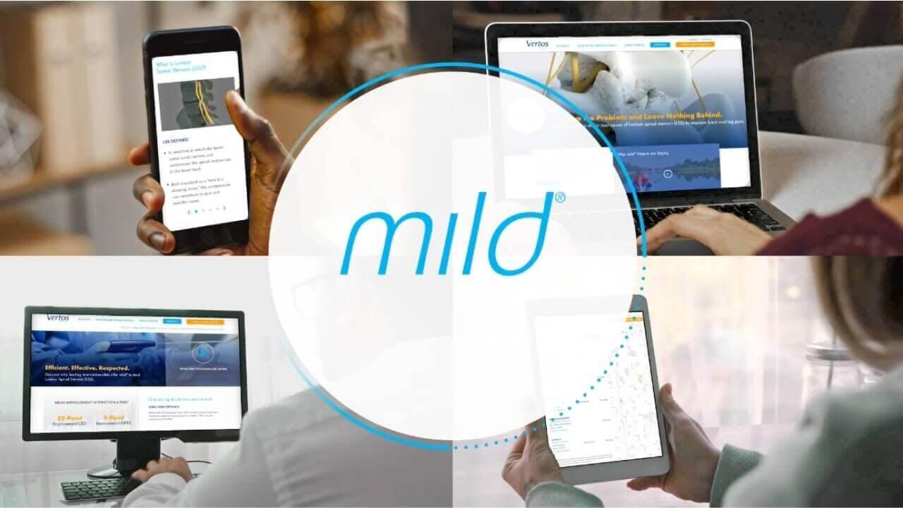 Mild Procedure Daytona Beach