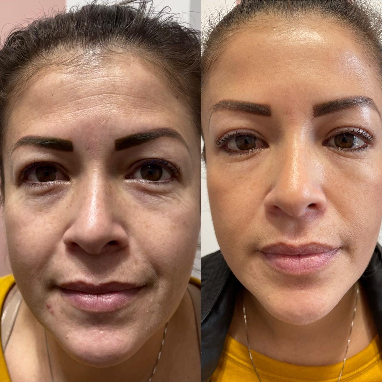 MM GLOW & LOVE FOR YOUR SKIN