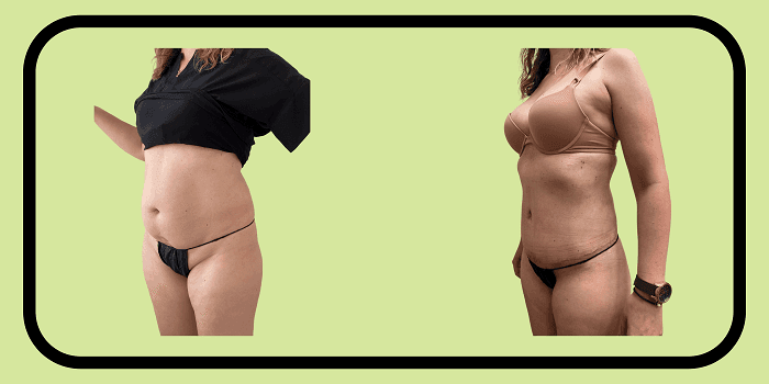 Adonis Plastic Surgery