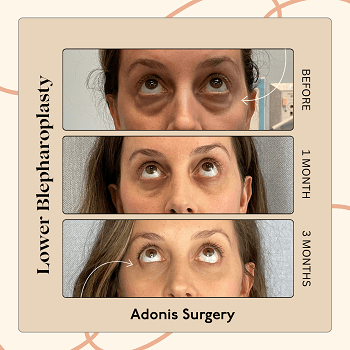 Adonis Plastic Surgery