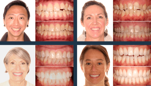 Kunik Orthodontics Austin