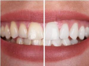 Robert B. Guttry, DDS