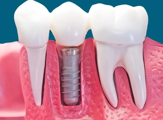 Robert B. Guttry, DDS