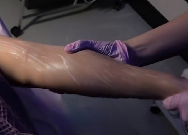 Add-on: Arm Treatment