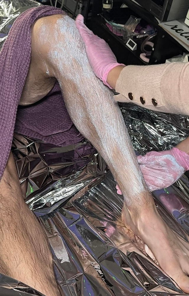 Add-on: Leg Treatment