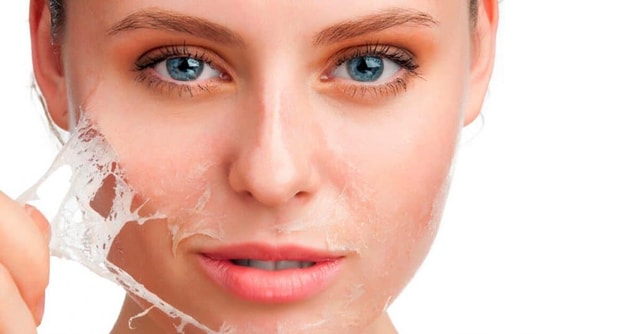 Silk Acne Scar Peel - ONE CHEECK
