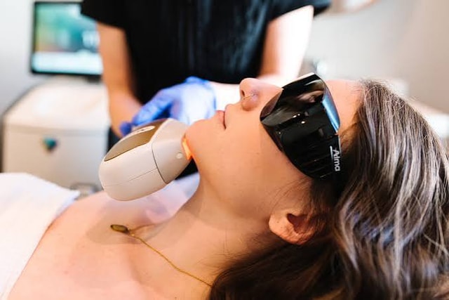 Chin Lase Hair Removal