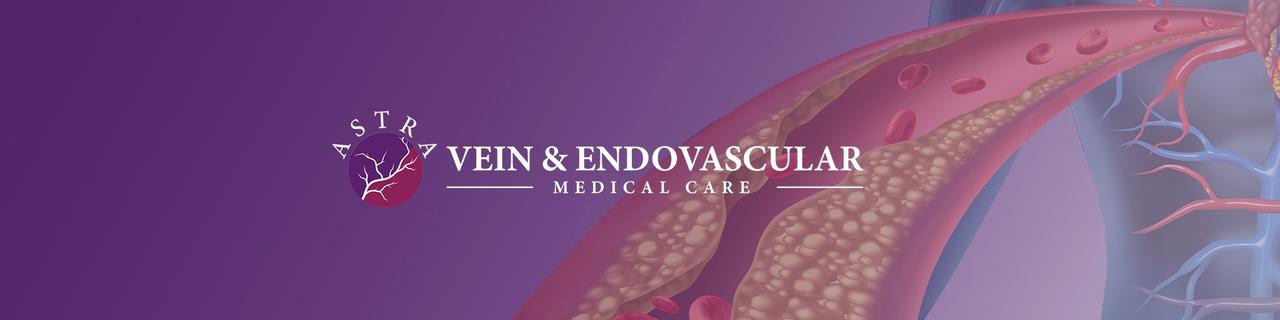 Astra Vein Treatment Center